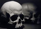 Найденный во Владивостоке пробитый человеческий череп просят опознать