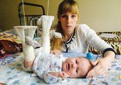 В Уссурийске детский хирург сломал 2-месячному ребенку обе ноги