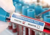 За упоминание коронавируса с целью наживы клиникам грозят штрафами
